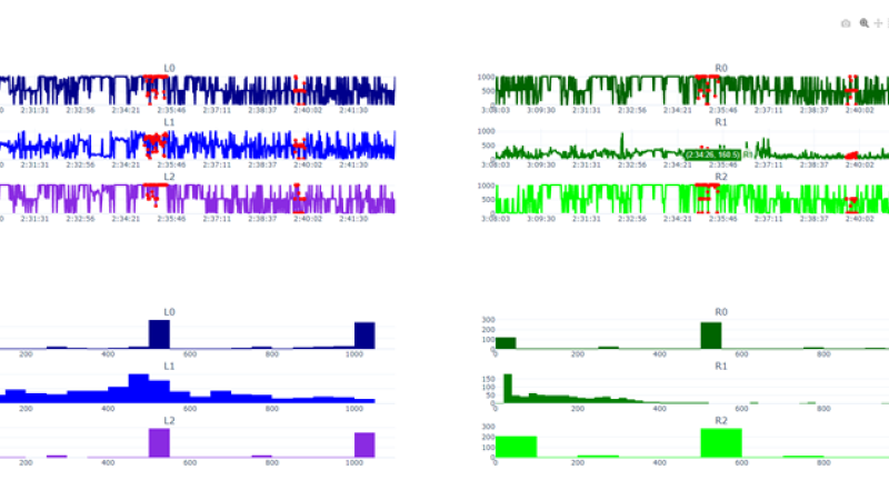 Process of walking data visualization for patient 1 subplots