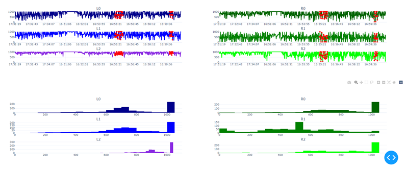 Process of walking data visualization for patient 4 subplots